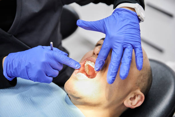Best Emergency Dental Care for Broken or Chipped Teeth in Hillsboro, ND